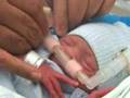 CPAP (Continuous Positive Airway Pressure)