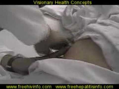 hepatic biopsy - Actual liver biopsy procedure from REAL HIV-HCV TREATMENT, a nine-module, CME-accredited, case-study series following the step-by-step process of hepatitis C...