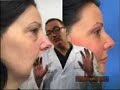 Fat Injection (transfer)- part 1-Introduction