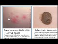 itchy skin rashes