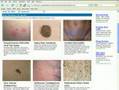 itchy skin rashes