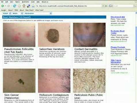 how to id a skin rash