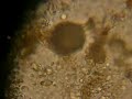Balantidium coli Balantidium coli