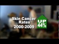 Doctor's at Nationwide Children's See Increase in Melanoma Cases Among Teens