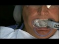 Ceric Crowns Mesa Arizona Family&Cosmetic Dental Practice 866 625-9220