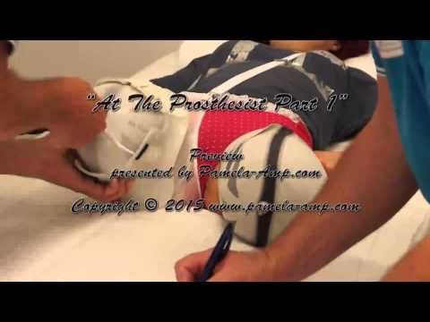 dak amputee - Video of DAK Amputee Pamela: http://www.pamela-amp.com/ This Video is available on my page Pamela-Amp.com: http://www.pamela-amp.com/epages/78137976.sf/en_GB...