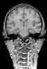 FMRI