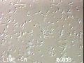 joseph's very motile bacillus