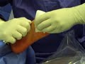 Chirurgie mini-invasive du pied