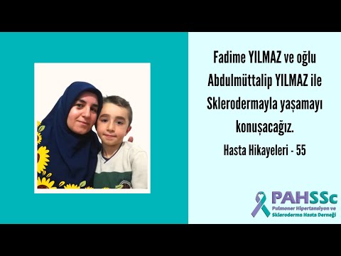 Hasta Hikayeleri - Fadime YILMAZ ve oğlu Abdulmüttalip YILMAZ ile Sklerodermayla Yaşamak - 55 - 2022.01.25