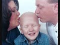 Hannah's Cancer Journey  Cancer Childhood Brain Tumors