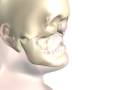 Near-Total Face Transplant Surgical Animation