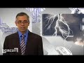 Laser Triggered Lightning Strikes? Sweet.