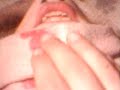 Thumbnail #1