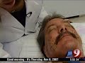 Male Botox