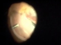 Click to View : 27G VIT