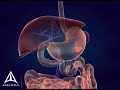 For more information about 3D medical animations, visit www.amerra.com. This animation shows a pancreaticoduodenectomy, pancreatoduodenectomy, Whipple procedure, or Kausch-Whipple procedure. This is a major surgical operation involving the pancreas, duodenum, and other organs. This operation is performed to treat cancerous tumours on the head of the pancreas or cancerous tumors on ducts or vessels near the pancreas.