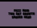 this is a report of a video of wormlike fibers coming from the skin on my scalp.  this was taken two days after shaving head.  video was shot fresh from the shower, air-dried as to not have any contact with environmental factors such as clothing, towels, etc.  i am reposting hoping to hear of someone else that has this.  or do we all have this stuff when viewed under black light?  i can scratch my skin and bring the stuff up from beneath the dermal layer.  it doesnt seem right...