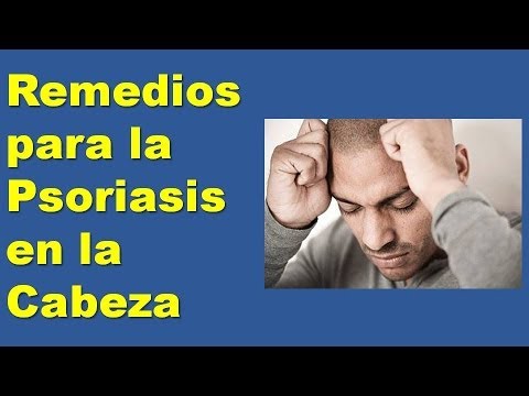 La psoriasis de la foto de la fase inicial el tratamiento en el pie
