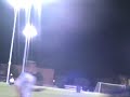 The worst broken arm I have ever seen in soccer