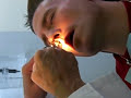 Doctor Removes Gummy Worms From Jay Terrien\