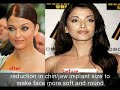 Aishwarya Rai had plastic surgery, before and after photos
