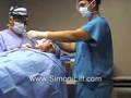 Simoni Lift, The Face lift of the Future, Actual procedure