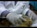 Anatom�a veterinaria: Sistema Nervioso 1