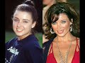 celebs plastic surgery celebs plastic surgery