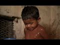 101 East - Affirmative action in Malaysia -20 Mar 08-Part 2