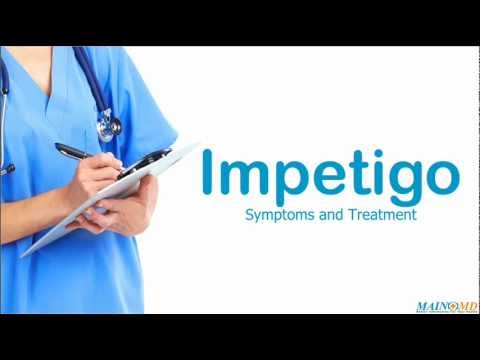 how to treat impetigo in adults
