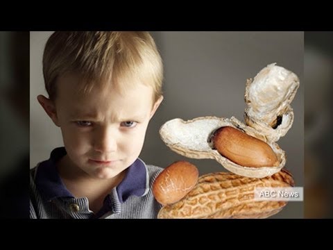 how to cure nut allergy