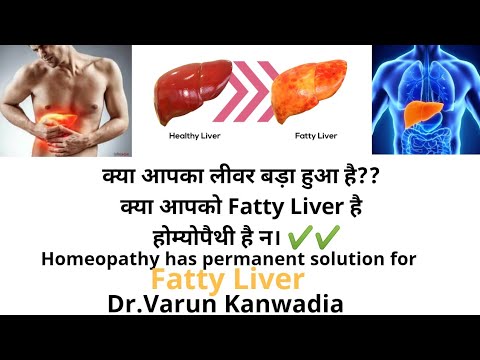 लीवर पर ज्यादा चर्बी को होम्योपथी से करे जड़ से खत्म । Homeopathy Treatment of Fatty Liver