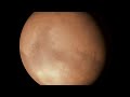Mars global dust storm