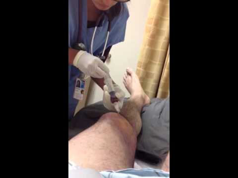 how to drain knee bursitis