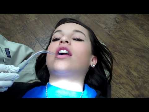how to fasten braces