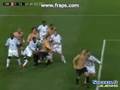 Steve Mandanda Vs LYon