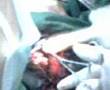eyeball inoculation
