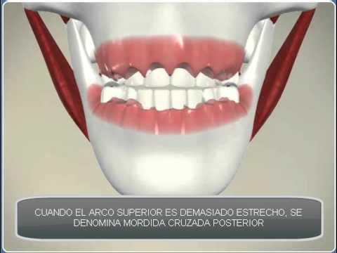 Imagen de previsualización de YouTube