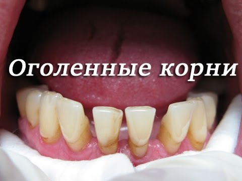 К чему снятся короткие волосы толкование сна, сонник К чему снится Молоко во сне по 90 сонникам!