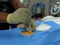 Epidural Steroid Injection