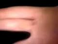 skem ii