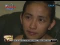 Batang nalapnos ang kaliwang binti, hindi pa maoperahan dahil kulang sa timbang