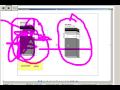 oracle data corruption oracle backup  ,oracle recoverey