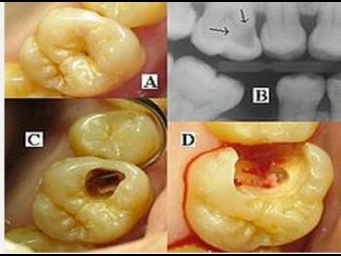 how to grow teeth back