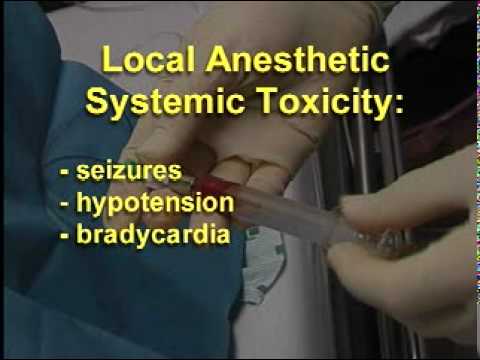 how to measure epidural catheter