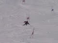 Matt's Ski Accident in Chile - 2005