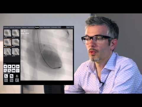 how to obtain ejection fraction
