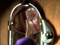 Pelvic+Examination View Video