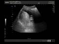 videos de Baby J
